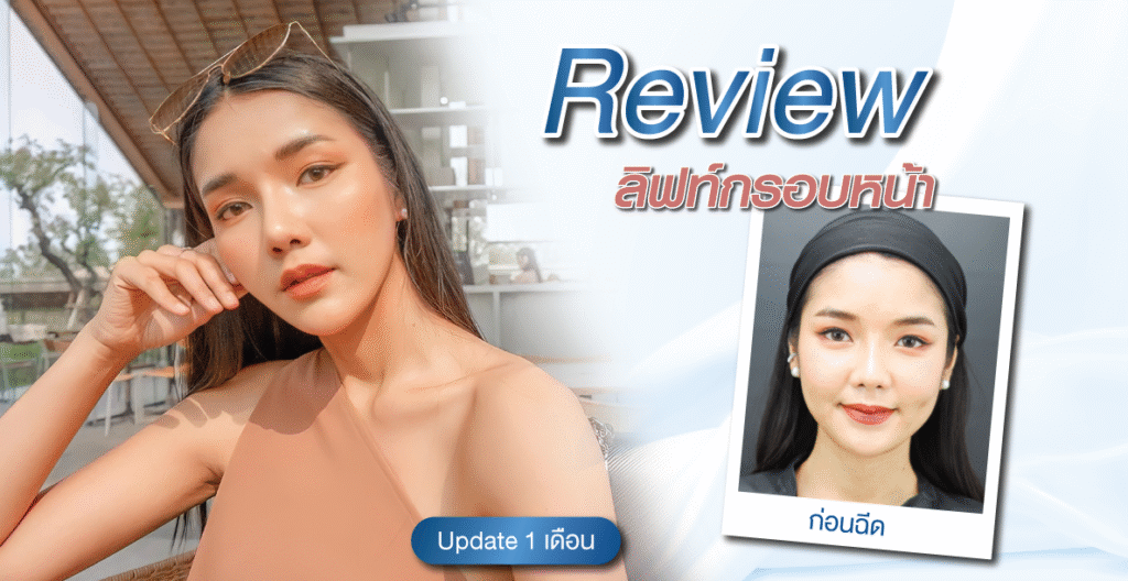 อยากเก็บกรอบหน้า ควรฉีดโบแบบไหนถึงเห็นผล